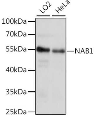 Western Blot: NAB1 Antibody [NBP2-93389] - Analysis of extracts of various cell lines, using NAB1 at 1:1000 dilution.Secondary antibody: HRP Goat Anti-Rabbit IgG (H+L) at 1:10000 dilution.Lysates/proteins: 25ug per lane.Blocking buffer: 3% nonfat dry milk in TBST.Detection: ECL Basic Kit .Exposure time: 10s.