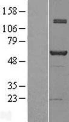 Western Blot: NAB1 Overexpression Lysate (Adult Normal) [NBL1-13452] Left-Empty vector transfected control cell lysate (HEK293 cell lysate); Right -Over-expression Lysate for NAB1.