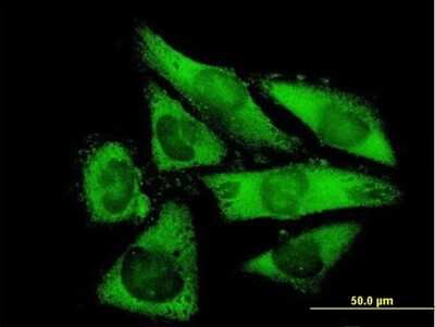 Immunocytochemistry/Immunofluorescence: NACA2 Antibody [H00342538-B01P] - Analysis of purified antibody to NACAL on HepG2 cell. (antibody concentration 10 ug/ml)