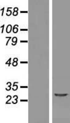 Western Blot: NACA2 Overexpression Lysate (Adult Normal) [NBL1-13455] Left-Empty vector transfected control cell lysate (HEK293 cell lysate); Right -Over-expression Lysate for NACA2.