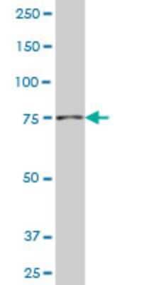 Western Blot NAD Synthetase Antibody (4G9) - Azide and BSA Free