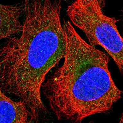 Immunocytochemistry/ Immunofluorescence NAD Synthetase Antibody - BSA Free