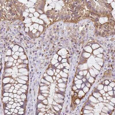 Immunohistochemistry-Paraffin NAD Synthetase Antibody