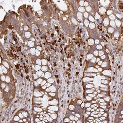 Immunohistochemistry-Paraffin: NAD Synthetase Antibody [NBP2-58373] - Staining of human rectum shows cytoplasmic positivity in glandular cells.