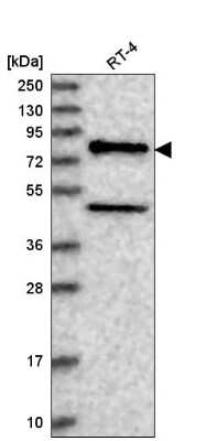 Western Blot NAD Synthetase Antibody