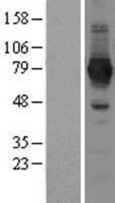 Western Blot: NAD Synthetase Overexpression Lysate (Adult Normal) [NBL1-13457] Left-Empty vector transfected control cell lysate (HEK293 cell lysate); Right -Over-expression Lysate for NAD Synthetase.
