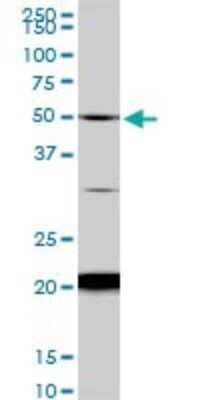 Western Blot NADK Antibody (5F4)