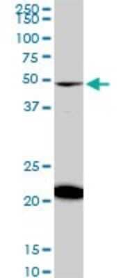 Western Blot: NADK Antibody (5F4) [H00065220-M01] - NADK monoclonal antibody (M01), clone 5F4. Analysis of NADK expression in Raw 264.7.