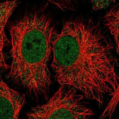 Immunocytochemistry/Immunofluorescence: NADK Antibody [NBP2-58769] - Staining of human cell line HeLa shows localization to nucleoplasm & vesicles.