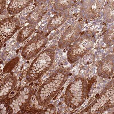 Immunohistochemistry-Paraffin: NADK Antibody [NBP2-13637] Staining of human stomach, upper shows distinct cytoplasmic positivity in glandular cells.