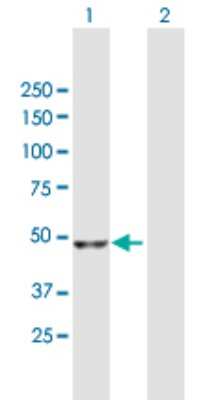 Western Blot: NADK Antibody [H00065220-B01P] - Analysis of NADK expression in transfected 293T cell line by NADK polyclonal antibody.  Lane 1: NADK transfected lysate(49.06 KDa). Lane 2: Non-transfected lysate.