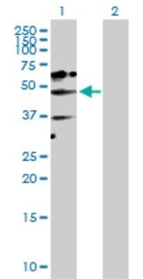 Western Blot: NADK Antibody [H00065220-D01P] - Analysis of NADK expression in transfected 293T cell line by NADK polyclonal antibody.Lane 1: NADK transfected lysate(49.20 KDa).Lane 2: Non-transfected lysate.