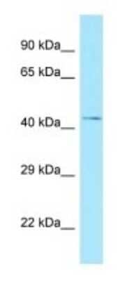 Western Blot: NADK Antibody [NBP1-98562] - Human Fetal kidney Lysate, concentration 1 ug/ml.