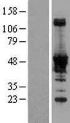 Western Blot: NADK Overexpression Lysate (Adult Normal) [NBL1-13456] Left-Empty vector transfected control cell lysate (HEK293 cell lysate); Right -Over-expression Lysate for NADK.