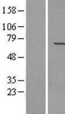 Western Blot: NAE1 Overexpression Lysate (Adult Normal) [NBL1-13459] Left-Empty vector transfected control cell lysate (HEK293 cell lysate); Right -Over-expression Lysate for NAE1.