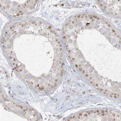 Immunohistochemistry-Paraffin NAF1 Antibody - BSA Free