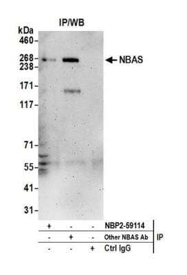 Immunoprecipitation: NAG Antibody [NBP2-59114] - Detection of human NBAS by western blot of immunoprecipitates. Samples: Whole cell lysate (0.5 or 1.0 mg per IP reaction; 20% of IP loaded) from Jurkat cells prepared using NETN lysis buffer. Antibodies: Affinity purified rabbit anti-NBAS antibody NBP2-59114 used for IP at 3 ul per reaction. NBAS was also immunoprecipitated by another rabbit anti-NBAS antibody. For blotting immunoprecipitated NBAS, NBP2-59114 was used at 1:1000. Detection: Chemiluminescence with an exposure time of 3 minutes.