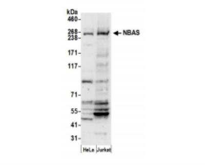 Western Blot: NAG Antibody [NBP2-59114] - Whole cell lysate (50 ug) from HeLa and 293T cells prepared using NETN lysis buffer. Antibody: Affinity purified rabbit anti-NBAS antibody used for WB at 1:1000. Detection: Chemiluminescence with an exposure time of 30 seconds.