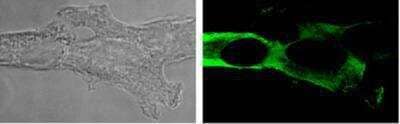 Immunocytochemistry/Immunofluorescence: NALP1 Antibody (Nalpy1-4) [NBP1-97593] - Detection of NLRP1/NALP1 in 293T cells transfected with a human NLRP1/NALP1 expression plasmid. Left: Phase contrast. Right: Staining with MAb to NLRP1/NALP1 (Nalpy1-4).Method: 293T cells transfected with full length human NLRP1/NALP1 were fixed with 4% paraformaldehyde and stained with 1ug/ml MAb to NLRP1/NALP1 (Nalpy1-4) and then Alexa 488 (1:300 dilution).