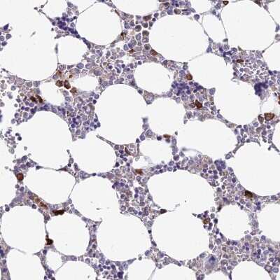 Immunohistochemistry-Paraffin: NALP12 Antibody [NBP1-85555] - Staining of human bone marrow shows moderate cytoplasmic positivity in hematopoietic cells.