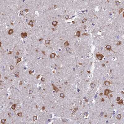 Immunohistochemistry-Paraffin: NALP12 Antibody [NBP1-85555] - Staining of human cerebral cortex shows strong cytoplasmic positivity in neurons.