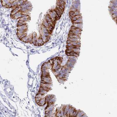 Immunohistochemistry-Paraffin NALP12 Antibody