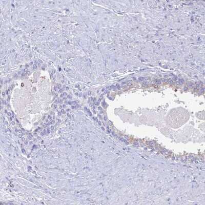 Immunohistochemistry-Paraffin: NALP12 Antibody [NBP1-85555] - Staining of human prostate shows no positivity in glandular cells as expected.