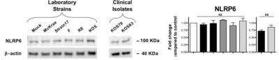 Western Blot: NALP12 Antibody [NBP1-76293] - B6 mice (n = 6) were infected ocularly with 2.5 x 105 pfu/eye of HSV-1 laboratory strains McKrae, 17, F, RE or KOS or with clinical isolates KOS79 and KOS63 (mock-infected mice (n = 6) used as controls). 48 hrs later, animals were euthanized & corneas were excised & homogenized in lysis buffer, and WB was performed for NLRP3, NLRP6, NLRP12, IFI16/p204, & AIM2 (beta-actin used as a control). Three WB performed using different corneal lysates harvested from three sets of corneas from 2 mice (4 corneas/lysate). Graphs (mean plus SD) show fold change in expression of NLRP3, NLRP6, NLRP12, IFI16/p204, and AIM2 at 48 hrs post-infection compared to controls, and normalized to beta-actin. Representative densitometric analysis is shown compared to control. Image collected and cropped by CiteAb from the following publication (//www.frontiersin.org/articles/10.3389/fimmu.2019.01631/full), licensed under a CC-BY license.