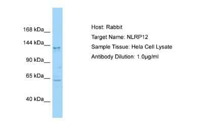 Western Blot: NALP12 Antibody [NBP2-87879] - Host: Rabbit. Target Name: NLRP12. Sample Type: Hela Whole Cell lysates. Antibody Dilution: 1.0ug/ml