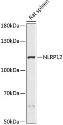 Western Blot: NALP12 Antibody [NBP2-93584] - Analysis of extracts of rat spleen, using NALP12 at 1:3000 dilution.Secondary antibody: HRP Goat Anti-Rabbit IgG (H+L) at 1:10000 dilution.Lysates/proteins: 25ug per lane.Blocking buffer: 3% nonfat dry milk in TBST.Detection: ECL Basic Kit .Exposure time: 90s.