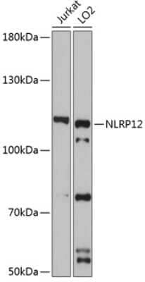 Western Blot: NALP12 Antibody [NBP2-94058] - Analysis of extracts of various cell lines, using NALP12 at 1:3000 dilution.Secondary antibody: HRP Goat Anti-Rabbit IgG (H+L) at 1:10000 dilution.Lysates/proteins: 25ug per lane.Blocking buffer: 3% nonfat dry milk in TBST.Detection: ECL Basic Kit .Exposure time: 90s.