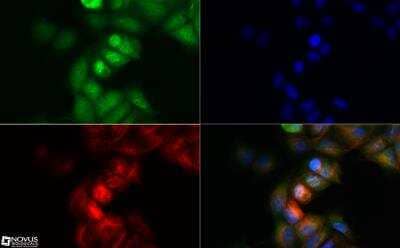 Immunocytochemistry/Immunofluorescence: NALP4 Antibody [NBP2-31375] - NALP4 antibody was tested in MCF7 cells with Dylight 488 (green). Nuclei and alpha-tubulin were counterstained with DAPI (blue) and Dylight 550 (red). An antibody concentration of 0.1 ug/ml was used. Image objective 40x.