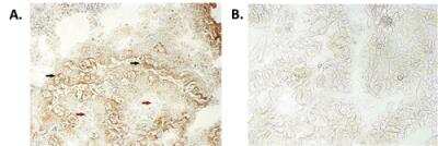 Immunohistochemistry: NALP6 Antibody (Clint-1) [NBP3-11675] - Immunohistochemical staining of bioptic sections of small intestine using NALP6 antibody (Clint-1) at 1:500 dilution. Method: A) Epithelial tissues which express NALP6 (positive control) (black arrows) and connective tissues which do not express NALP6 (negative control) (red arrows) are stained using Clint-1. B) Control confirming non-reactive specificity of the secondary antibody without Clint-1.