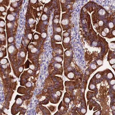 Immunohistochemistry: NALP6 Antibody [NBP2-47362] - Staining of human small intestine shows strong cytoplasmic and membranous positivity in glandular cells.