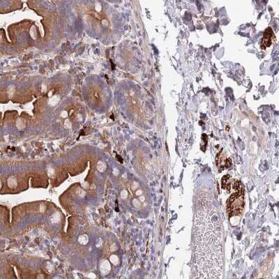 Immunohistochemistry: NALP6 Antibody [NBP2-48908] - Staining of human small intestine shows strong cytoplasmic positivity in glandular cells and peripheral nerves.