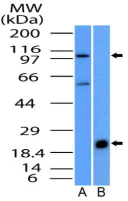 Western Blot NALP6 Antibody