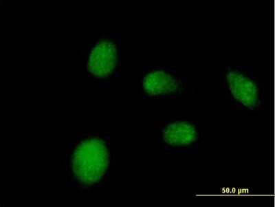 Immunocytochemistry/Immunofluorescence: NANP Antibody [H00140838-B01P] - Analysis of purified antibody to NANP on HeLa cell. (antibody concentration 10 ug/ml)