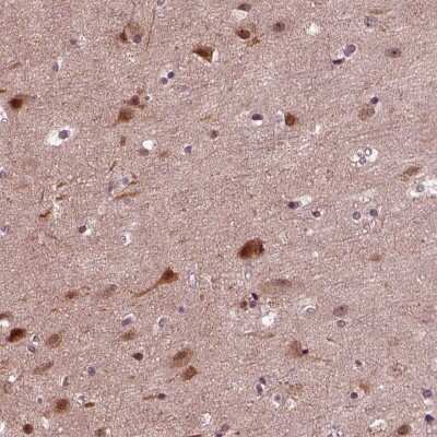 Immunohistochemistry-Paraffin: NAP1L5 Antibody [NBP2-55379] - Immunohistochemical staining of human cerebral cortex shows moderate cytoplasmic and nuclear positivity in a subset of neuronal cells.