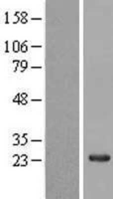 Western Blot: NAP1L5 Overexpression Lysate (Adult Normal) [NBL1-13473] Left-Empty vector transfected control cell lysate (HEK293 cell lysate); Right -Over-expression Lysate for NAP1L5.