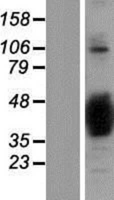 Western Blot: NAPB Overexpression Lysate (Adult Normal) [NBP2-06477] Left-Empty vector transfected control cell lysate (HEK293 cell lysate); Right -Over-expression Lysate for NAPB.