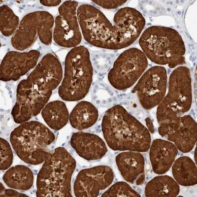 Immunohistochemistry-Paraffin: NAPE-PLD Antibody [NBP2-48571] - Staining of human kidney shows strong cytoplasmic positivity in cells in tubules.