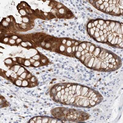 Immunohistochemistry-Paraffin: NAPE-PLD Antibody [NBP2-48571] - Staining of human rectum shows strong cytoplasmic positivity in glandular cells.