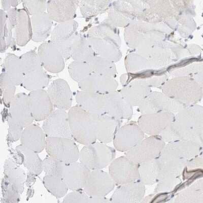 Immunohistochemistry-Paraffin: NAPE-PLD Antibody [NBP2-48571] - Staining of human skeletal muscle shows no positivity in myocytes as expected.