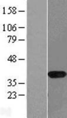 Western Blot: NAPG Overexpression Lysate (Adult Normal) [NBL1-13477] Left-Empty vector transfected control cell lysate (HEK293 cell lysate); Right -Over-expression Lysate for NAPG.