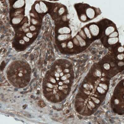 Immunohistochemistry: NAPRT1 Antibody (CL0366) [NBP2-52924] - Staining of human duodenum shows strong cytoplasmic positivity in glandular cells.