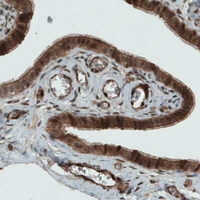 Immunohistochemistry-Paraffin: NAPRT1 Antibody (CL0366) [NBP2-52924] - Staining of human fallopian tube shows strong immunoreactivity in the epithelial cells.