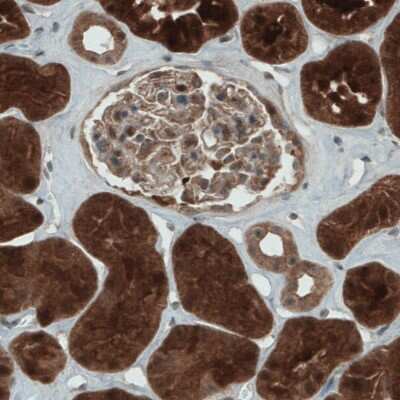 Immunohistochemistry-Paraffin: NAPRT1 Antibody (CL0366) [NBP2-52924] - Staining of human kidney shows strong cytoplasmic immunoreactivity in renal tubules.