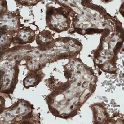 Immunohistochemistry-Paraffin: NAPRT1 Antibody (CL0366) [NBP2-52924] - Staining of human placenta shows strong immunoreactivity in the trophoblasts.