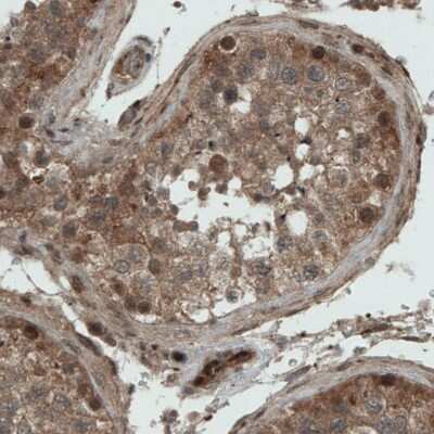 Immunohistochemistry-Paraffin: NAPRT1 Antibody (CL0366) [NBP2-52924] - Staining of human testis shows strong positivity in the seminiferous ducts.