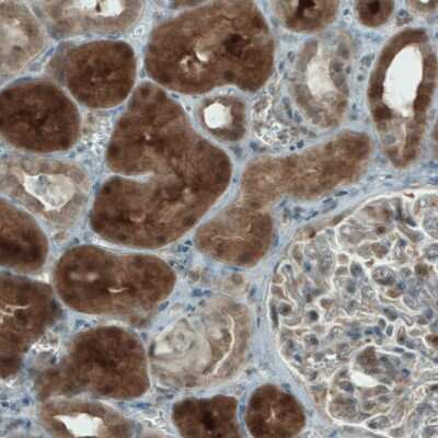 Immunohistochemistry-Paraffin: NAPRT1 Antibody (CL0665) [NBP2-52954] - Staining of human kidney shows strong cytoplasmic immunoreactivity in renal tubules.